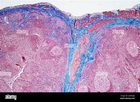 Palatine Tonsil Light Micrograph Of A Section Through The Surface Of A