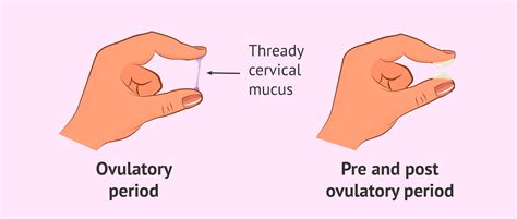 Fertile Cervical Mucus