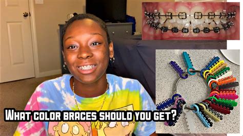 What Color Braces Should You Get The Best And Worse Colors Youtube