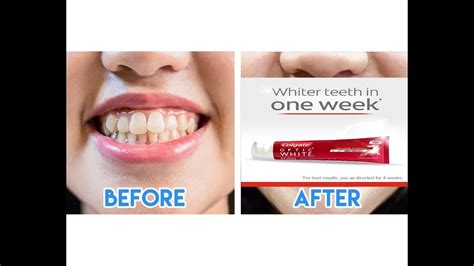 i tried a whitening toothpaste for 14 days i before and after i colgate white optic youtube