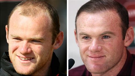 Ve shaqiri röportaja türkçe, ''merhaba arkadaş'' diyerek başlıyor. Wayne Rooney Haartransplantation : Machte Xherdan Shaqiri ...