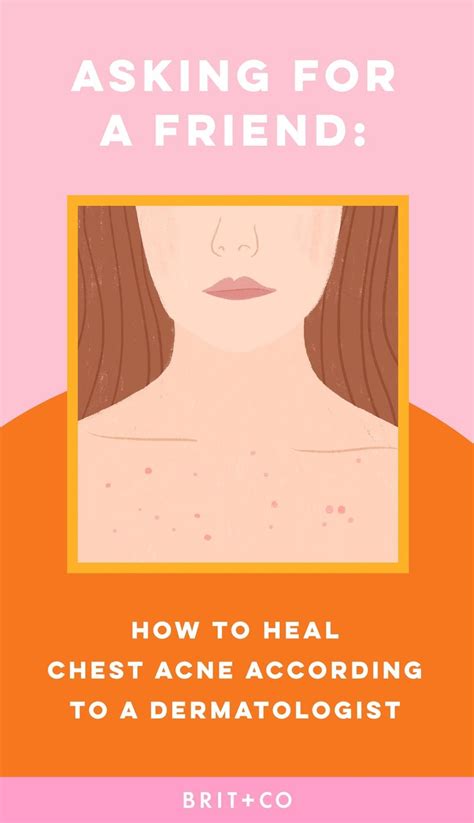 This Is How To Heal Chest Acne According To Dermatologists Brit Co