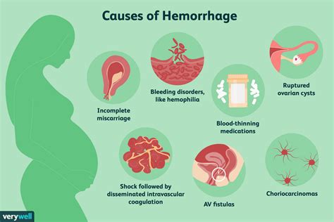How To Know If You Re Hemorrhaging Due To A Miscarriage