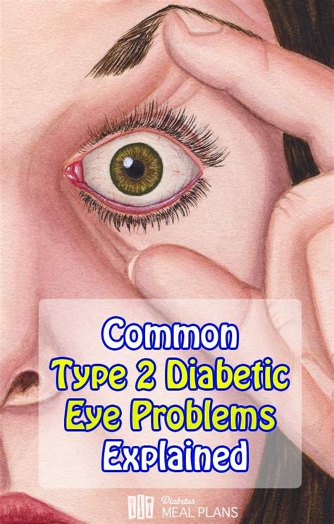 Common Diabetic Eye Problems Explained Diabetic Eye Problems Eyes