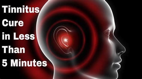 How To Cure Tinnitus Naturally In 5 Minutes How To Cure Tinnitus