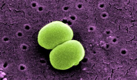 Free Picture Scanning Electron Micrograph Two Staphylococcus