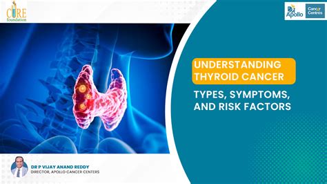 Understanding Thyroid Cancer Types Symptoms And Risk Factors
