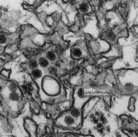 Electron Micrograph Zika Virus Photos And Premium High Res Pictures