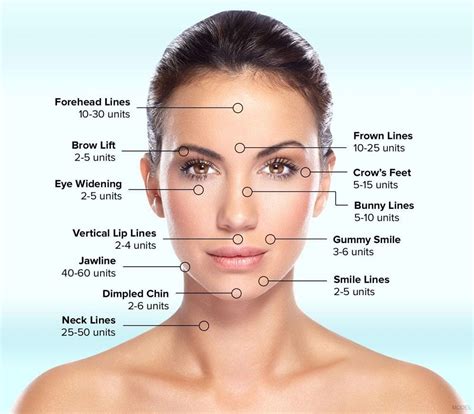 Botox Face Map