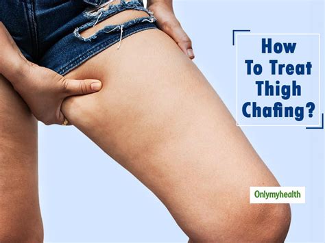 Avoid Thigh Chafing With These 7 Home Remedies Avoid Thigh Chafing