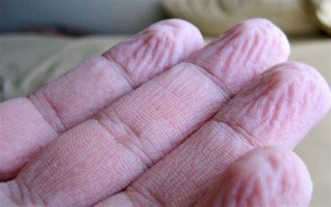 why does the skin on your hands and feet go wrinkly after swimming
