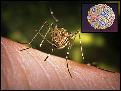 Explained What Is West Nile Virus All About Symptoms Diagnosis Treatment Precautions And