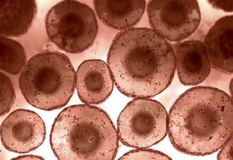 Reprogramming Human Skin Cells To Produce Insulin