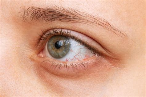 Premium Photo Disease Of Retina Of The Eye Closeup Of Female Eye With
