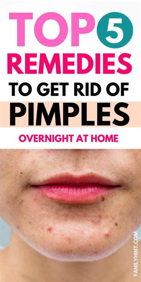 Do You Really Want To Know How To Get Rid Of Pimples Overnight Fast