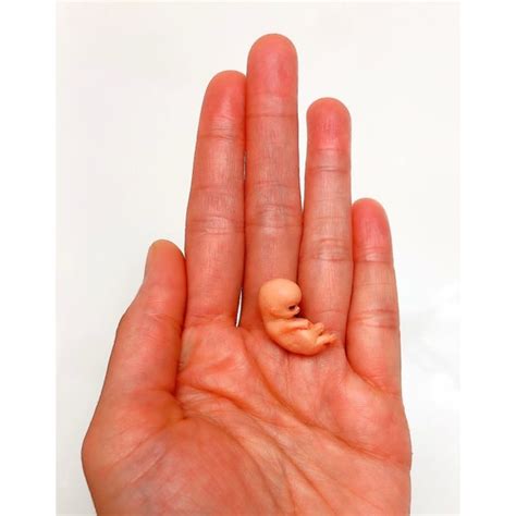 9 Week Gestation Embryo Stage Of Fetal Development Etsy