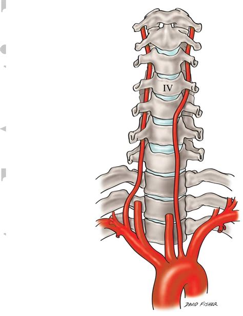 Aortic Arch Origin Of The Left Vertebral Artery An Anatomical And
