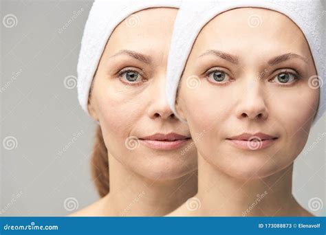Pretty Mature Girl Before And After Portrait Anti Wrincle Healthy Therapy Stock Image Image
