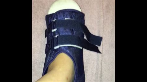 Broken Toe And Boot Update What It Looks Like Now Youtube