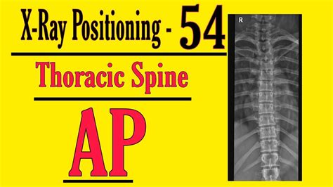 Thoracic Spine Ap Projection Hindi X Ray Positioning For