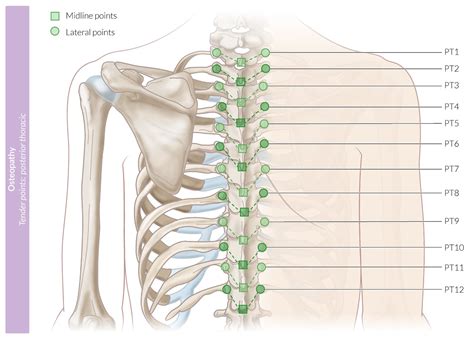 Posterior Trigger Points Neck