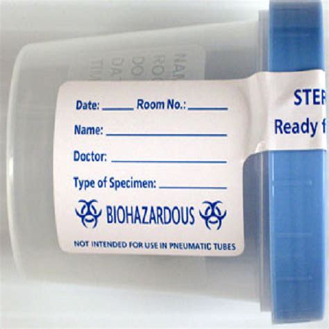 Specimen Containers Sterile 4 Oz Lexicon Medical Supply