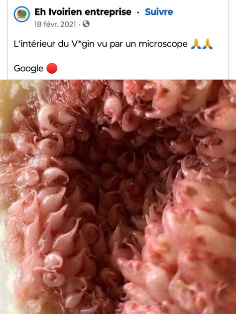 photo sensationnelle l intérieur du vagin vu au microscope fait le buzz sur internet