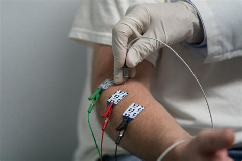If its jab is proven to be safe and effective, the company aims to deliver at least 1 billion doses by the end of the year. Guillain-Barré syndrome: Symptoms, causes, diagnosis, and ...