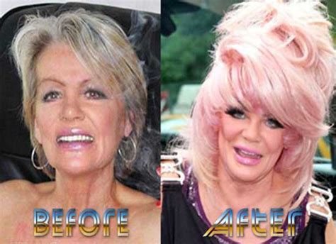 Jan Crouch Plastic Surgery Before And After Top Piercings