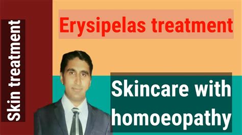 Erysipelas ।।skin Infection।। Homoeopathic For Erysipelas ।।skin