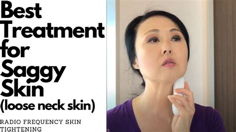 Best Treatment For Loose Neck Skin Radio Frequency For Skin Tightening