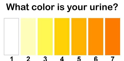 Urine Color Meaning Adult And Pediatric Urology Urine Color Chart