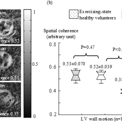 A Examples Of Correlation Maps With Spatial Coherence Measurements