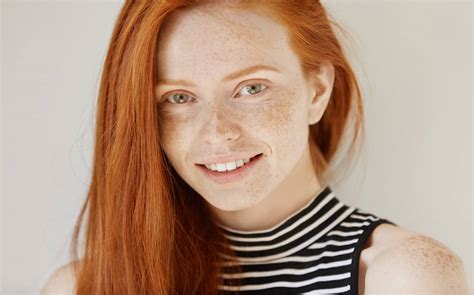 Why Do Freckles Appear Frequently On The Skin In The Summer