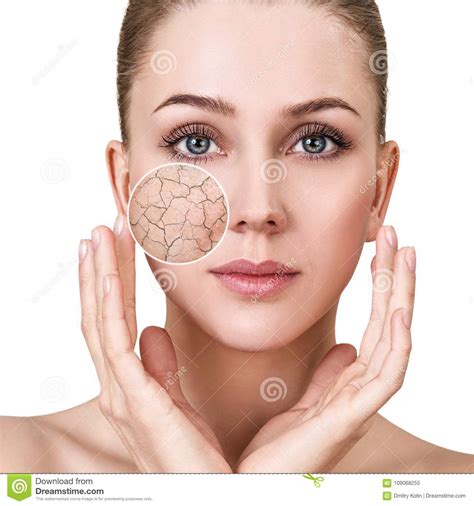 Zoom Circle Shows Facial Skin Before Moistening Stock Image Image Of
