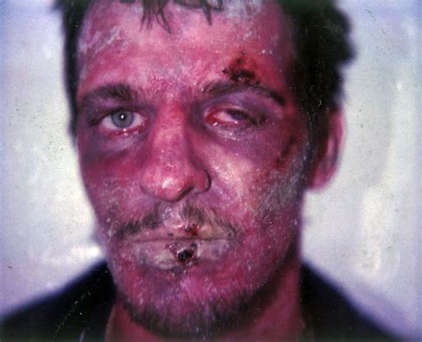 The true story of two climbers and their perilous journey up the west face of siula in 1985 two friends, joe simpson and simon yates, set out to climb siula grande in peru via the west face, a hitherto unaccomplished feat by any climber. Final Stages of Joe Simpson's Make-Up | Sarita Allison