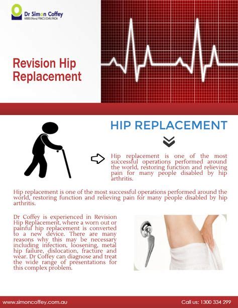 25 Total Hip Replacement Surgery Recovery Ideas Hip Replacement
