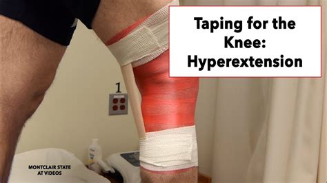Taping For The Knee Hyperextension YouTube