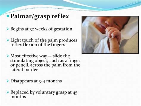 Palmar Grasp Reflex Newborn Congestion Reflexes Preventive Dentistry