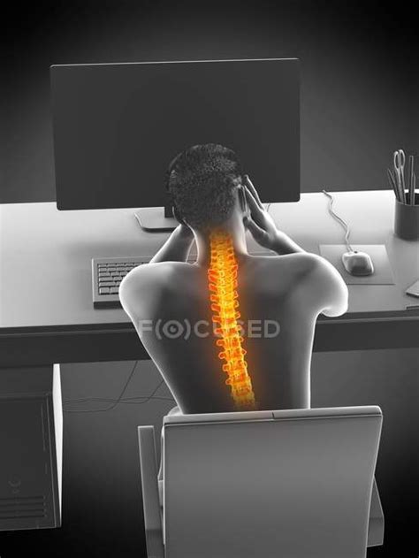 Stressed Office Worker With Back Pain In Rear View Conceptual