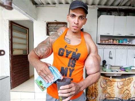 Romario Dos Santos Alves Injecting Oil Into Muscles Almost Cost Him His Arm Au