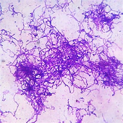 Grams Staining Showing Long Filamentous Branched Gram Positive