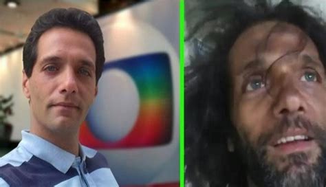 Em Ribas ex ator da Globo que está em situação de rua foi atendido no hospital da cidade TL