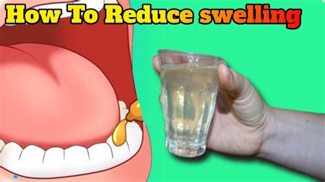 Swollen Gums Behind Teeth What Can Cause Swollen Gums Healthy Site