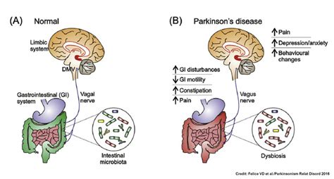 New Insights Into The Role Of Gut Microbiota In Parkinsons Disease