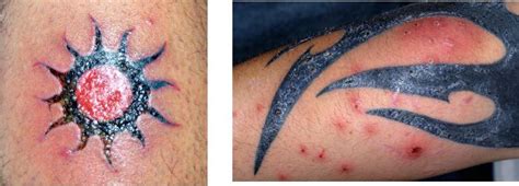 Feb 09, 2012 · this month's clinical infectious diseases evaluated the transmission of hcv through tattooing and piercing. ᐅ Recomendaciones al tatuarse para nuestra salud ⚡️ ...
