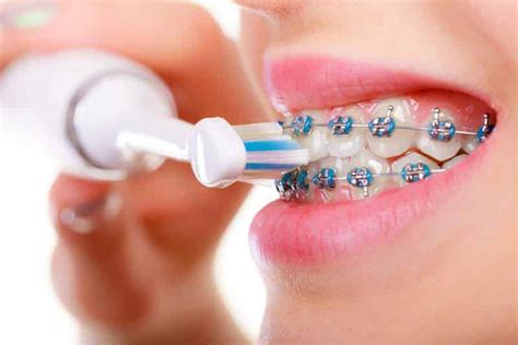 Best Toothbrush For Braces 2021 Dentist Recommended