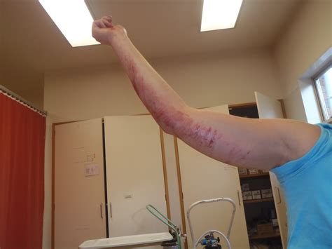How long does it take for benadryl to kick in?jul 2, 2019benadryl is quickly absorbed after oral administration and peak effects are reached within one hour. Consumer Report: "Don't Take Benadryl Every Day." Long ...