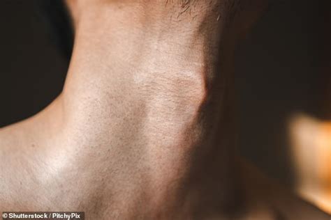 sexist body terms like adam s apple should no longer be used doctor says daily mail online