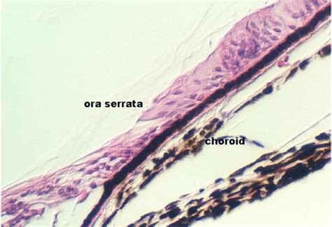 Retina Sclera And Choroid Microanatomy Web Atlas Gwen V Childs